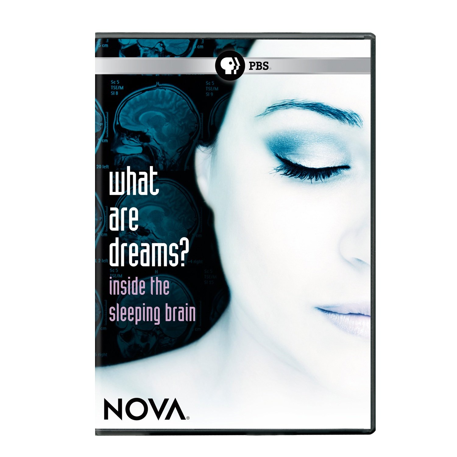 NOVA: What Are Dreams? - Zdjęcie 1 z 1
